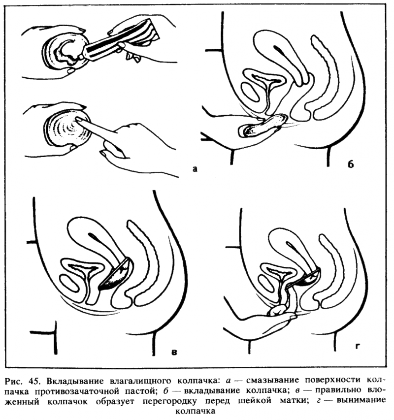 Искусство любви - _47.png