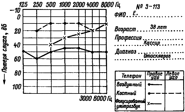 Коснуться невидимого, услышать неслышимое - i_024.png